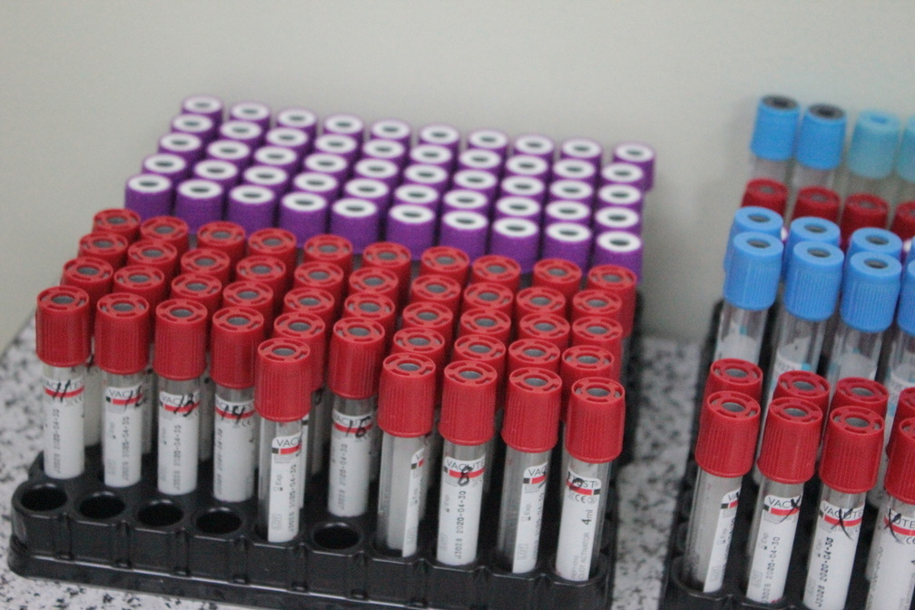 Бурков надеется на помощь спонсоров при покупке тестов на антитела COVID-19