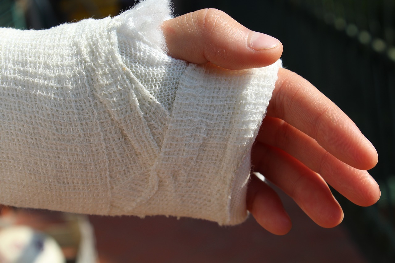 В Омске 42-летняя рецидивистка сломала руку взрослому мужчине